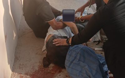Accidente en Hermosillo deja a menor con amputación parcial de pierna