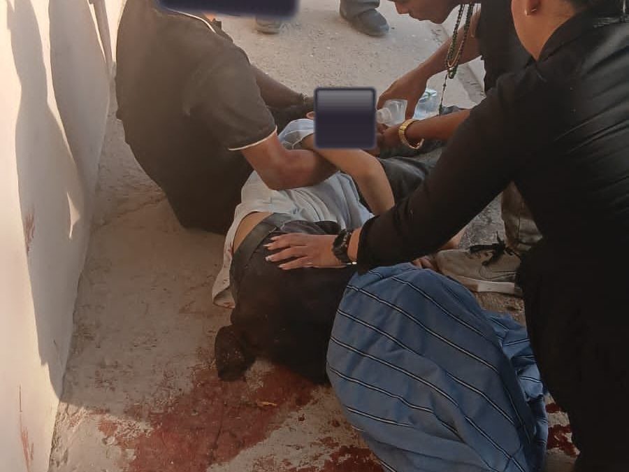 Accidente en Hermosillo deja a menor con amputación parcial de pierna