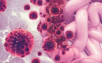 Cómo las células del cáncer de colon pueden cambiar de identidad para propagarse, según una investigación